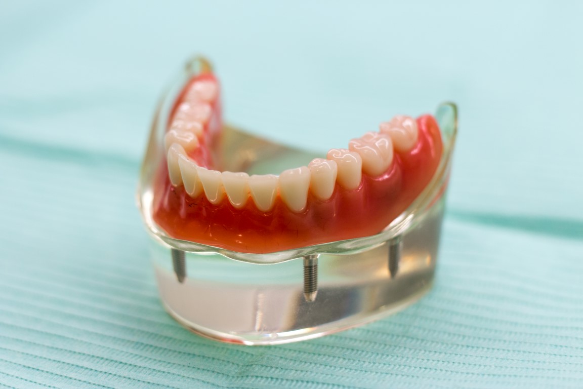 Prótesis dentales en Reus